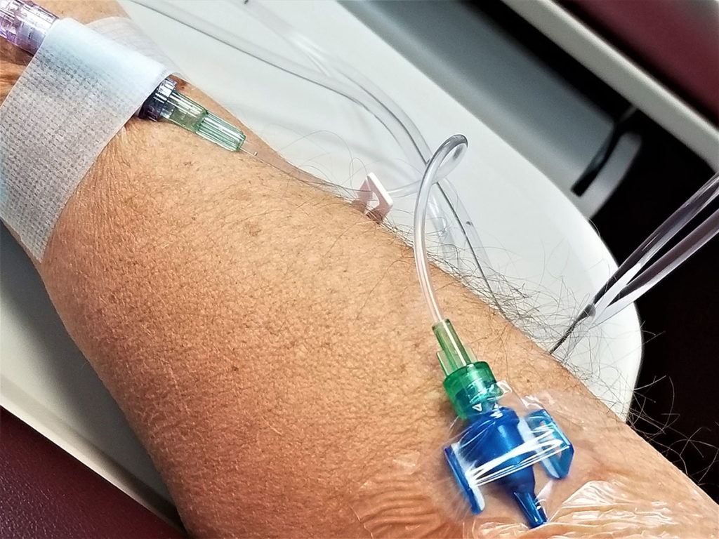 Chemo pump: Definition and how they work